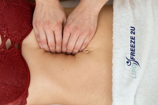 diastasis recti treatment Stoke-upon-Trent
