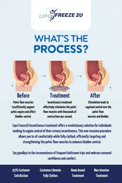 Diagram of how incontinence treatment Stoke-upon-Trent works.