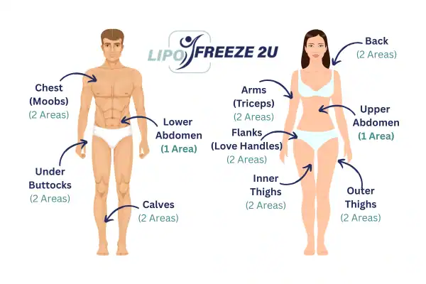 Areas you can have fat freezing treatment Stoke-upon-Trent