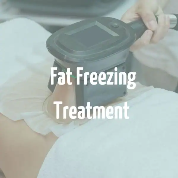 fat freezing treatment Stoke-upon-Trent
