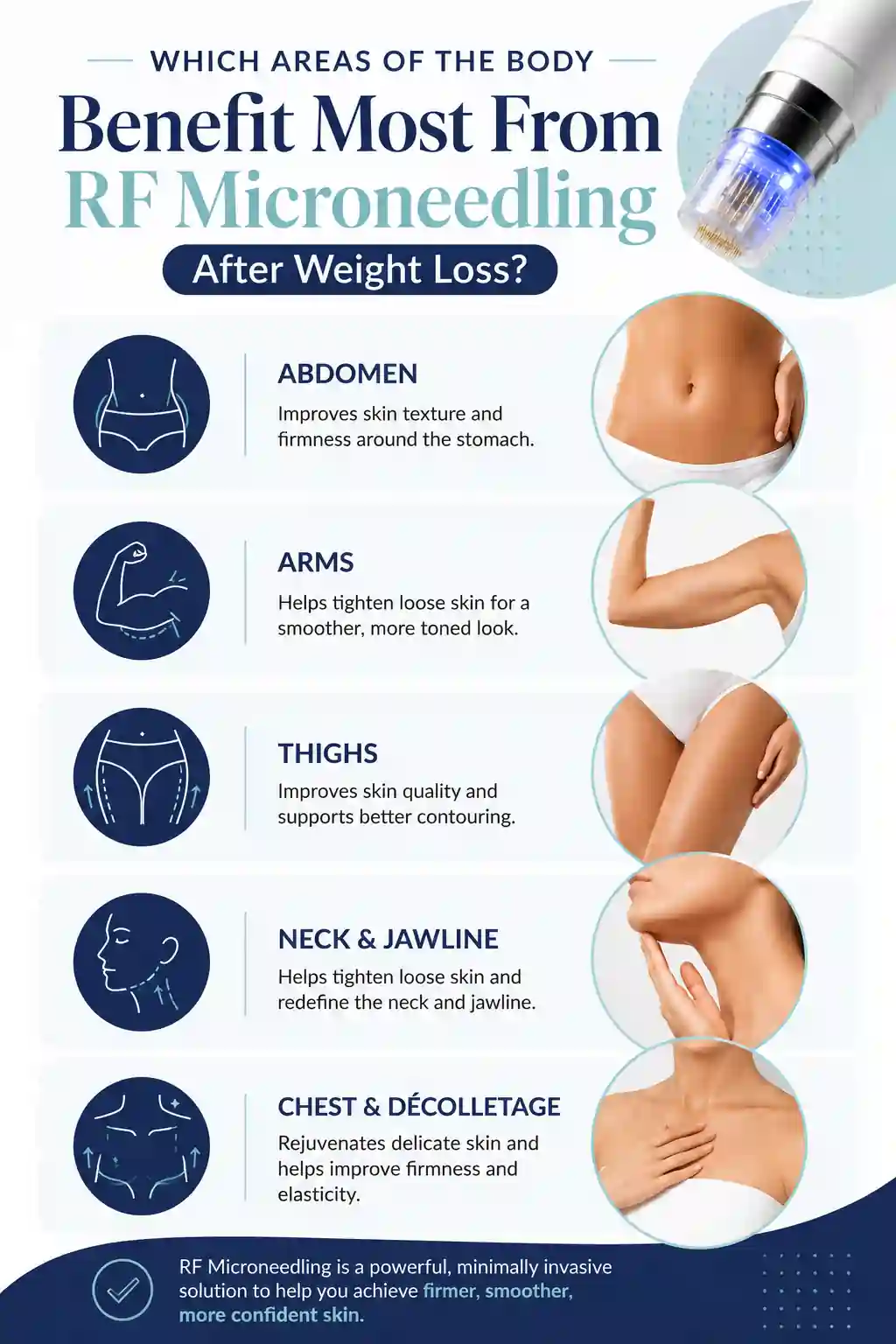 Which Areas of the Body Benefit Most From RF Microneedling After Weight Loss Stoke-upon-Trent